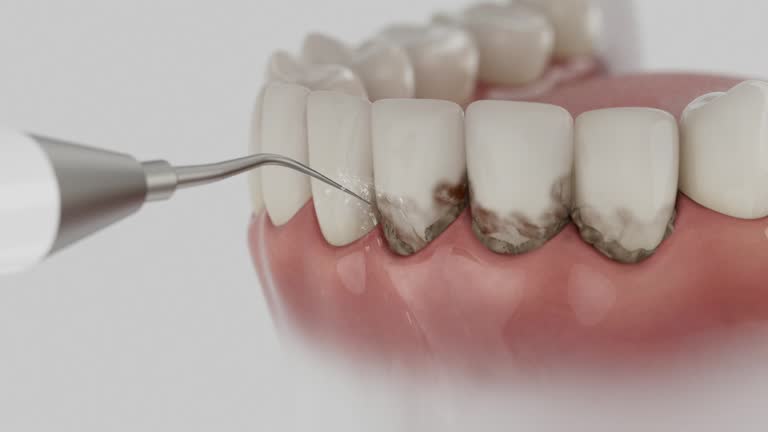 Reliable Dental Implants contractor in Forestville, OH by Smile Center Dentistry